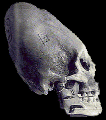 image of an elongated skull possibly Nephilim